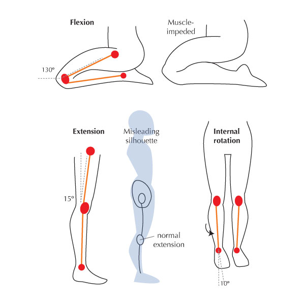 Nom : The-knee.jpg
Affichages : 3579
Taille : 33,8 Ko